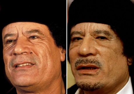 Muammar Khadafi: Operasi Plastik Tanpa Bius