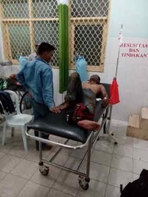 2 Pekerja SPBU di Tanjungpinang Terbakar Saat Bersihkan Tangki