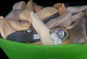 Terinspirasi Lady Di, Pasangan Ini Rutin Donasikan Organ Prostetik ke Ghana