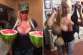 Lacey Wildd, Wanita yang Obsesi Punya Payudara Super Besar Ukuran QQQ