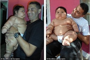 Bayi Super Gendut, Umur 8 Bulan Tapi Bobotnya Sama dengan Anak 6 Tahun