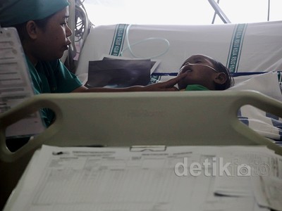 Kondisi Iqbal Masih Kritis