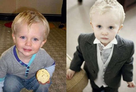 Keliru Diagnosis, Bocah Ini Meninggal Sia-sia Karena Infeksi Langka