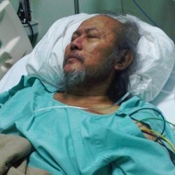 Dirawat Lagi di Rumah Sakit, Kondisi Pepeng Semakin Membaik