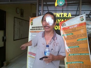 Melerai Pemotor yang Berkelahi di Jalan di Cipinang, Suharto Malah Kena Bogem