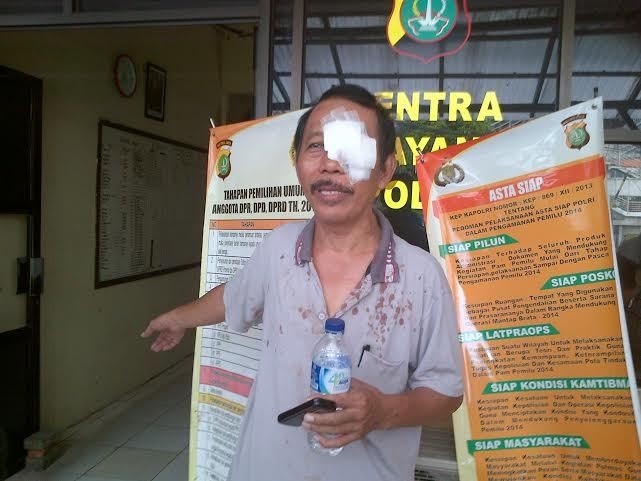 Melerai Pemotor yang Berkelahi di Jalan di Cipinang, Suharto Malah Kena Bogem