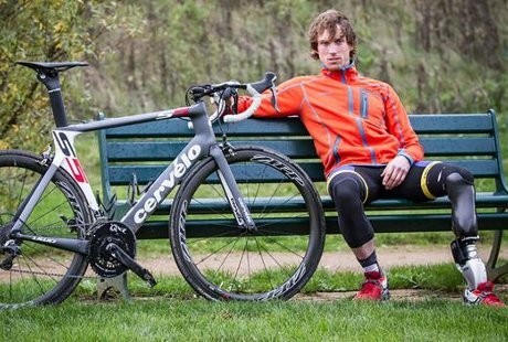 Mengenal Jozef Metelka, Pria yang Punya 13 Kaki