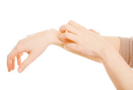 Jarang Diketahui, 10 Benda Ini Bisa Picu Reaksi Alergi