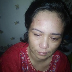 Nur, TKI ini Disiksa Majikannya di Jeddah dan Butuh Pertolongan