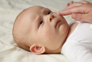 Ini Dia 3 Jenis Alergi Terpopuler yang Rentan Dialami Bayi dan Anak