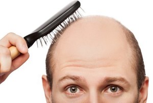 Rambut Tubuh Hanya Lebat di Bagian Tertentu, Ini Sebabnya