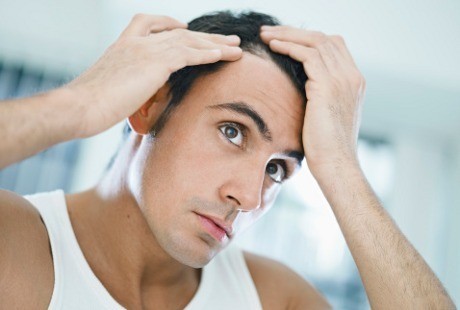 Infografis: Serba-serbi Transplantasi Rambut