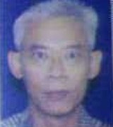 Mengapa Nexavar Tak Masuk Coverage BPJS?