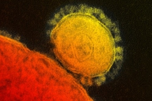5 Hal yang Turis Perlu Tahu Soal Virus Mers
