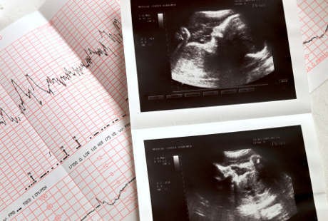 Wow! Ini Hal-hal Menakjubkan yang Bisa Dilakukan Bayi di dalam Kandungan