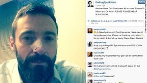Mengenal Penyakit Basal-cell carcinoma, Kanker Kulit Ganas yang Menyerang Hugh Jackman