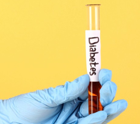 Studi: Makan Dua Kali Sehari Lebih Efektif Kendalikan Diabetes Tipe 2