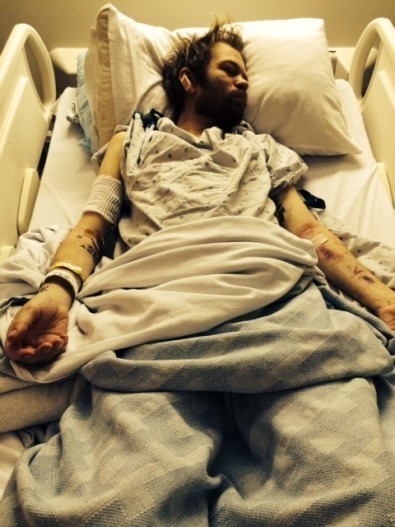 Sekali Lagi Minum Alkohol, Vokalis Sum 41 Terancam Tewas