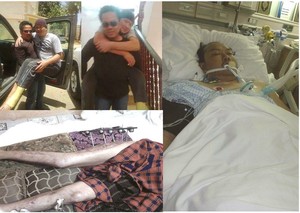 Tanpa Bantuan Dana KJRI Jeddah, WNI di Saudi Urunan untuk Suroto Korban Tabrak Lari