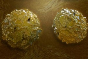 Orang Gemuk Berisiko Nyeri Tulang Jika Jadi Donor Stem Cell, Benarkah?