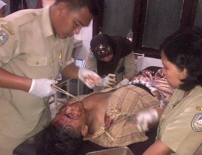 Digorok, Pelajar SMA Ini Berhasil Lolos dari Upaya Pembunuhan