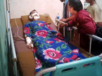 Sumur Minyak PetroChina Terbakar, 3 Pekerja Terluka