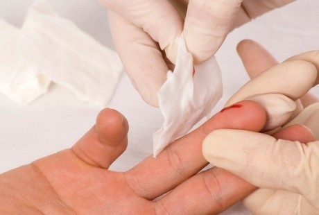 Ini Sebabnya Bekas Luka di Kulit Susah Hilang