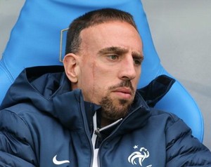 Giroud: Ribery Mulai Waswas dengan Cederanya