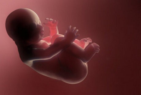 Bayi Rentan Autis Kalau Terpapar Banyak Hormon Pria?