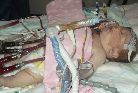 Alami Komplikasi, Bayi Termuda dengan Jantung Buatan Ini Meninggal Dunia