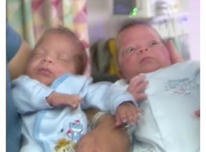Anak Kembar Ini Lahir Berbeda Usia 24 Hari