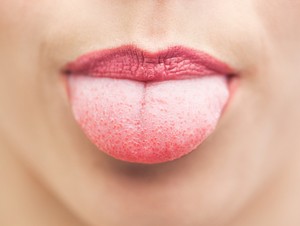 Benarkah, Lidah Manusia Bisa Melacak Rasa Karbohidrat?