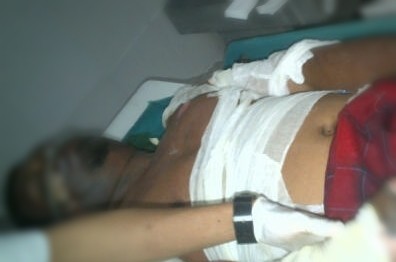 Kerabat Juru Parkir Dibakar di Monas Cari-cari Dana untuk Operasi