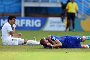 Dokter Gigi: Gigitan Luis Suarez Berisiko Tularkan Infeksi