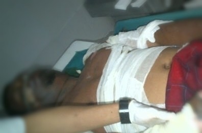 Kasus Jukir Liar Monas Dibakar, LPSK Apresiasi Aksi Cepat Puspom TNI AD