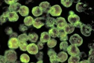 Cegah Virus Meluas, Liberia Akan Hukum Pasien Ebola yang Bersembunyi