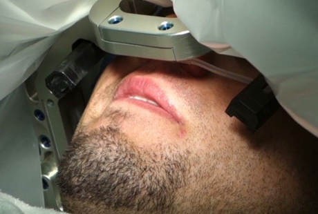 Stimulasi Otak Dalam, Harapan Baru untuk si OCD