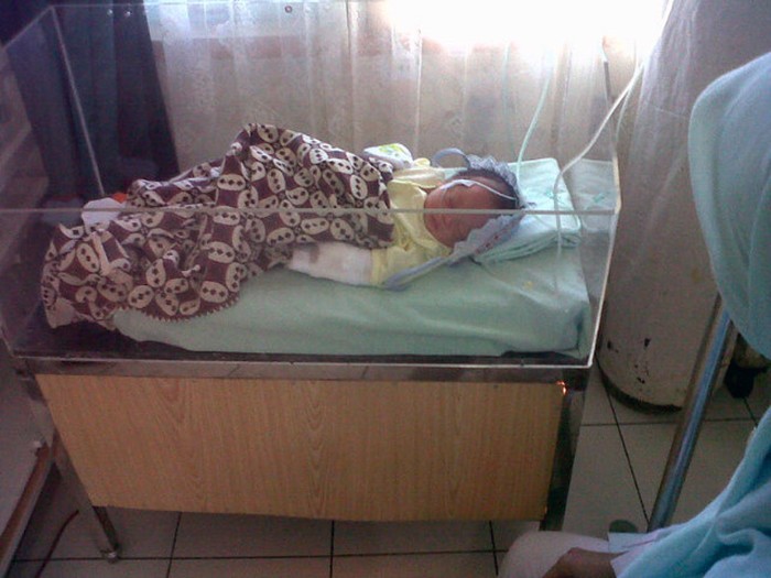 Kata Saksi soal Mukjizat yang Bikin Bayi Selamat Meski Dikubur Hidup-hidup