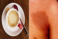 Tak Hanya Enak, Makanan Pun Bisa Bantu Diagnosis Penyakit