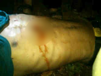 Ini Penampakan Mayat Pria di Dekat Kampus IISIP