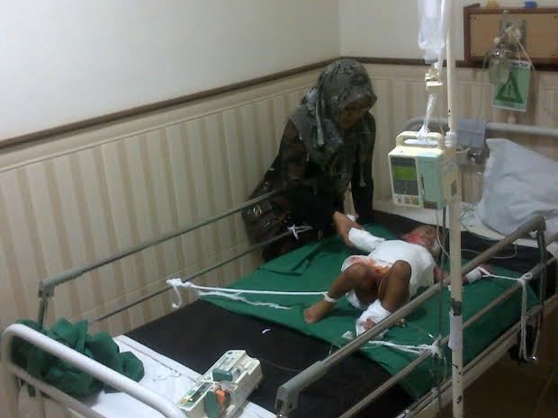 65% Tubuhnya Terguyur Kolak Mendidih, Bayi ini Butuh Bantuan