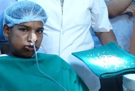 Dioperasi Selama 7 Jam, 232 Gigi Remaja Ini Dicabut