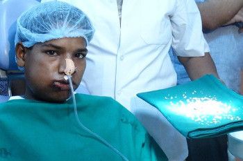 Ashik Gavai, Remaja 17 Tahun yang 232 Giginya Dicabut