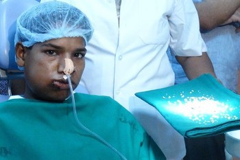 Ashik Gavai, Remaja 17 Tahun yang 232 Giginya Dicabut