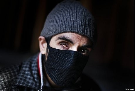 Tak Cuma Timbulkan Kebutaan, Peluru Air Gun Juga Bisa Tertanam di Kepala