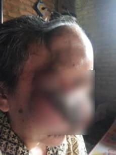 Tolong! Wajah Bapak ini Memilukan dan Butuh Pertolongan