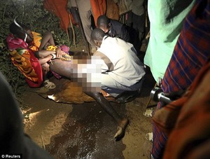 Kejantanannya Dikeluhkan Istri, 12 Pria Disunat Paksa di Kenya
