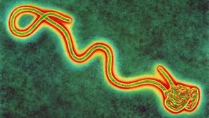 Pasien Kedua Ebola Tiba di AS untuk Mendapat Perawatan Lebih Lanjut