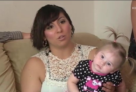 Ibunya Tersambar Petir Saat Hamil, Rambut Kimberly Berdiri Tegak Saat Lahir