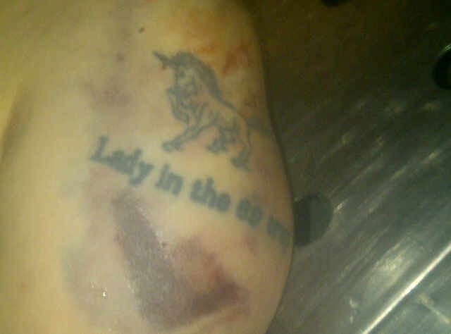 Ada Luka di Kepala Mayat Wanita Bertato Lady in The 69 Trup